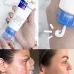 Acne Clear Facial Foam Face Wash